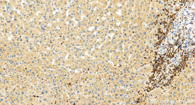RASAL3 Antibody in Immunohistochemistry (Paraffin) (IHC (P))