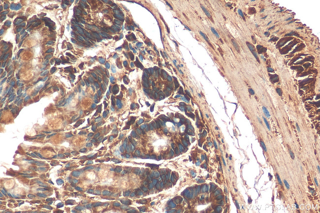 AMDHD1 Antibody in Immunohistochemistry (Paraffin) (IHC (P))