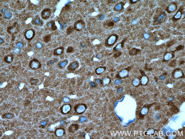 NSF Antibody in Immunohistochemistry (Paraffin) (IHC (P))