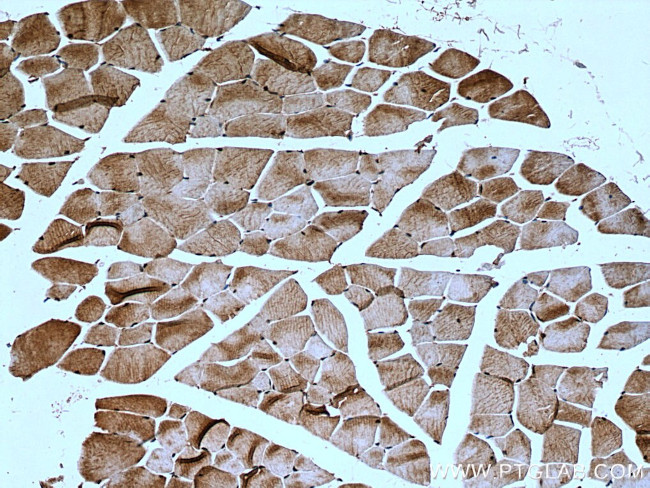 MYLK2 Antibody in Immunohistochemistry (Paraffin) (IHC (P))