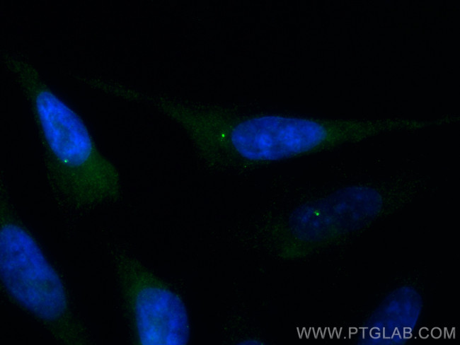 C20orf19 Antibody in Immunocytochemistry (ICC/IF)