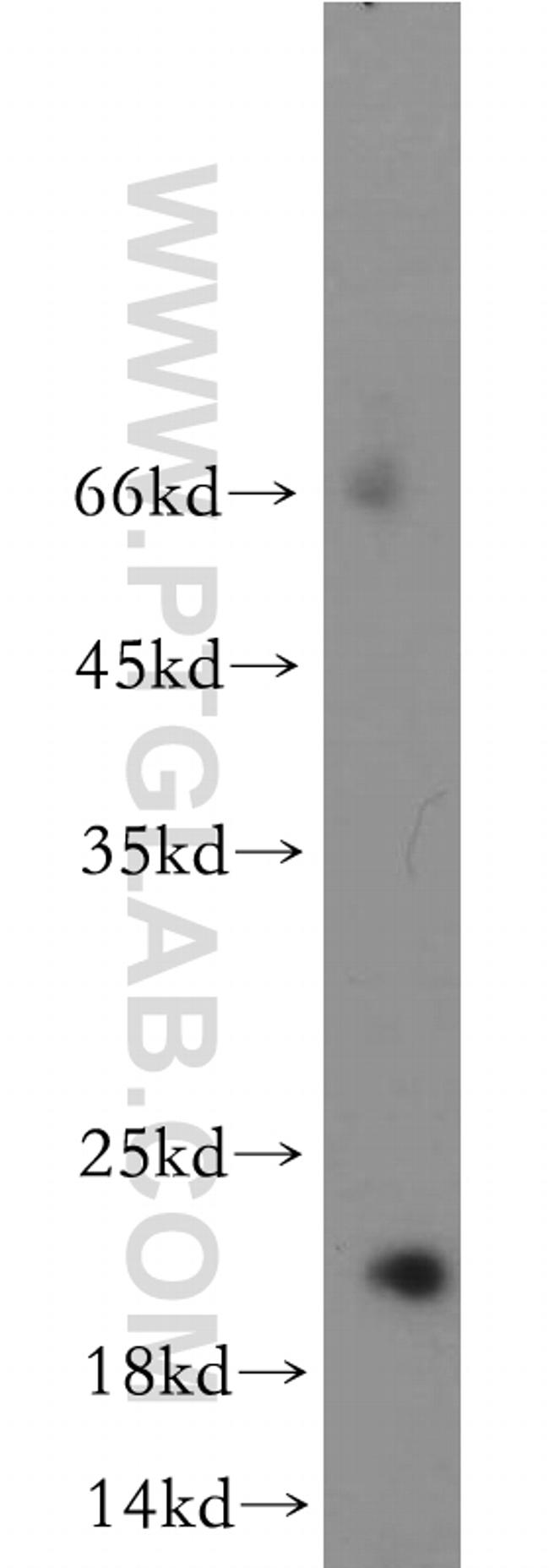 RNF212 Antibody in Western Blot (WB)