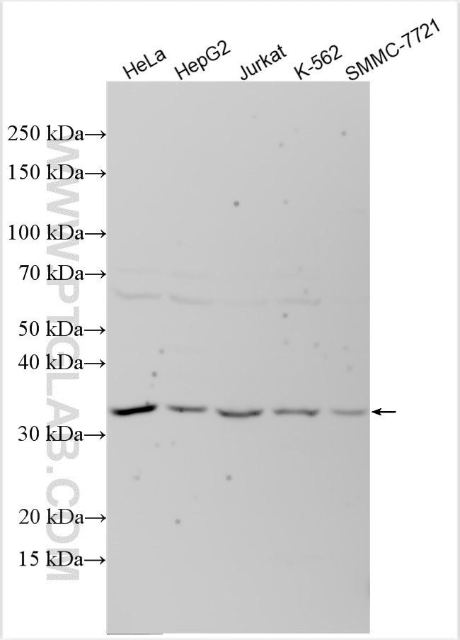 ARHGEF39 Antibody in Western Blot (WB)