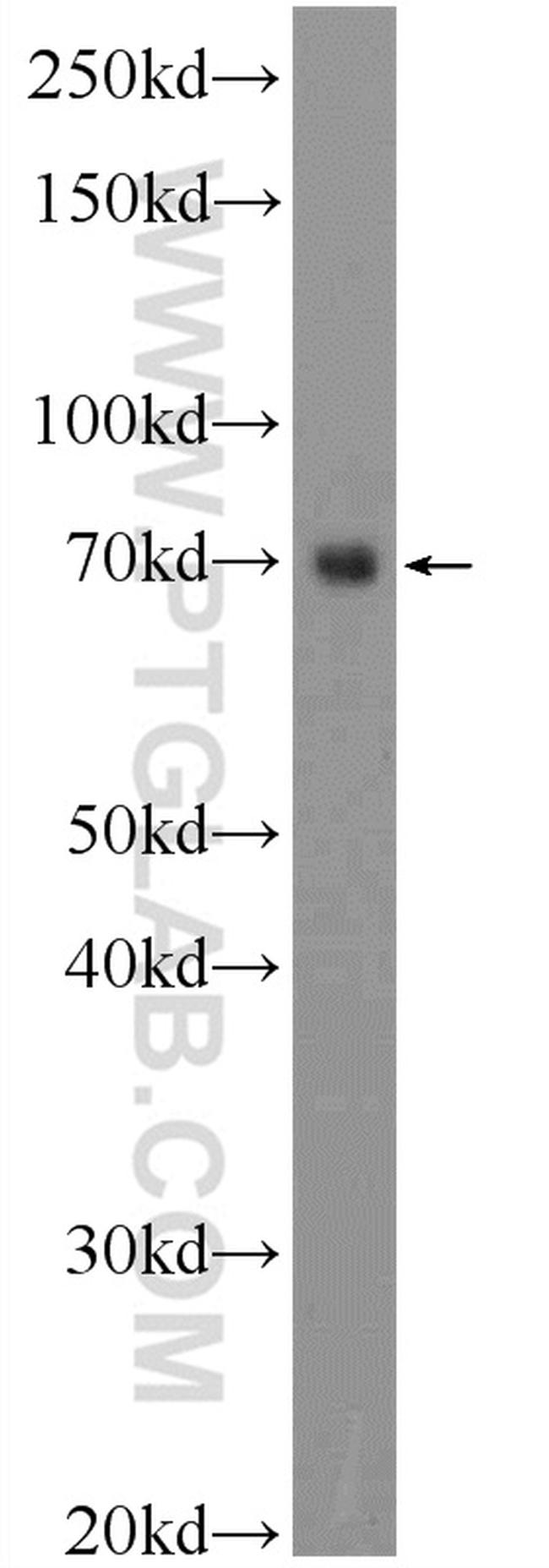 TTC30B Antibody in Western Blot (WB)
