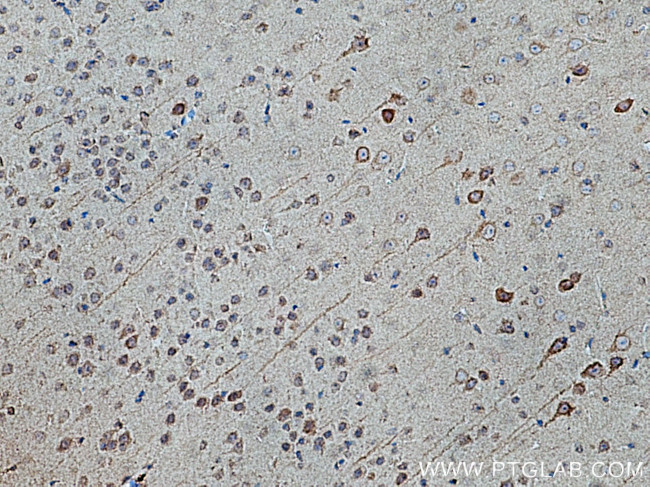 KIF5A Antibody in Immunohistochemistry (Paraffin) (IHC (P))