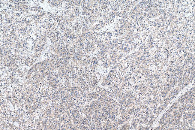 TAOK2 Antibody in Immunohistochemistry (Paraffin) (IHC (P))