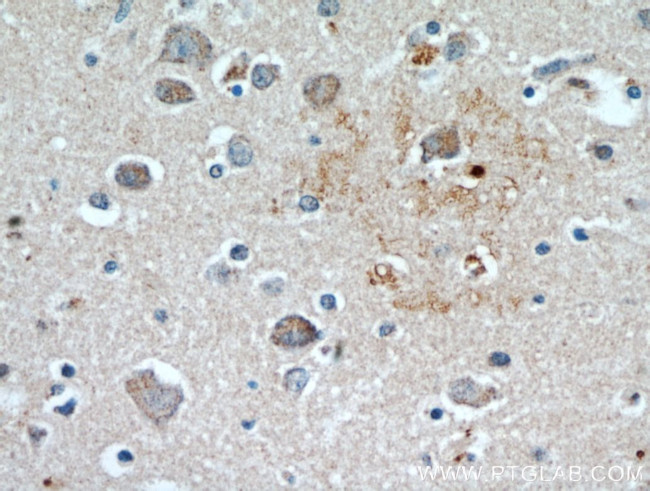 KLHL4 Antibody in Immunohistochemistry (Paraffin) (IHC (P))