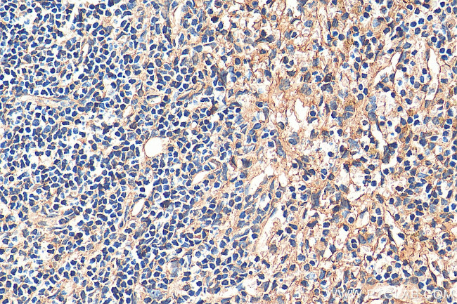 STIM2 Antibody in Immunohistochemistry (Paraffin) (IHC (P))