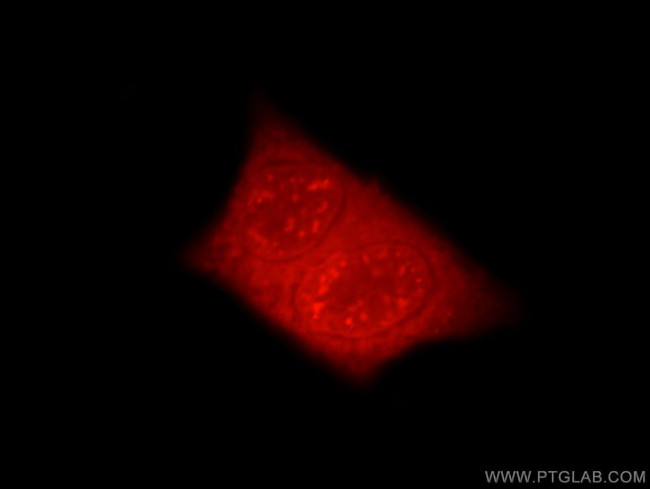 EYA3 Antibody in Immunocytochemistry (ICC/IF)
