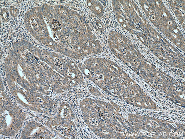 FAM72 Antibody in Immunohistochemistry (Paraffin) (IHC (P))