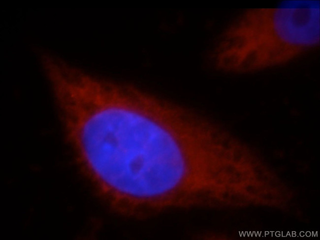 HSPA4 Antibody in Immunocytochemistry (ICC/IF)
