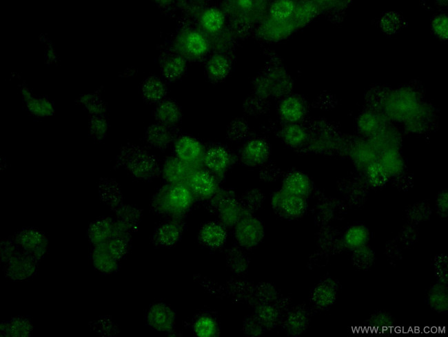 TET2 Antibody in Immunocytochemistry (ICC/IF)