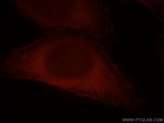 CCDC25 Antibody in Immunocytochemistry (ICC/IF)