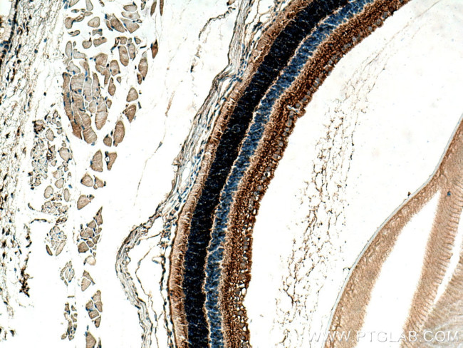 CPLX4 Antibody in Immunohistochemistry (Paraffin) (IHC (P))