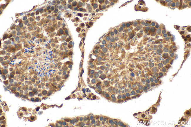 MORN2 Antibody in Immunohistochemistry (Paraffin) (IHC (P))