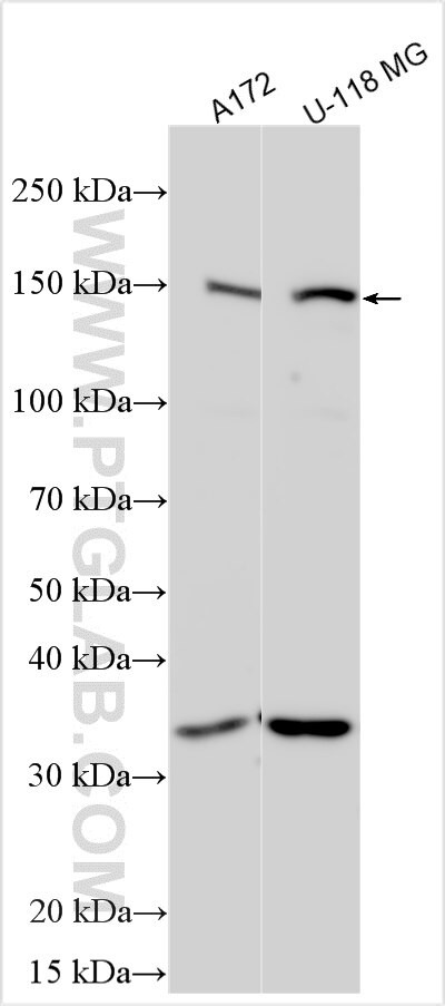 TRHDE Antibody in Western Blot (WB)