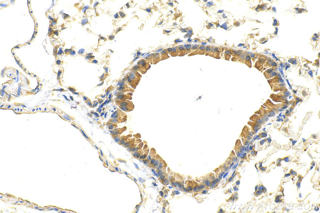 TAC4 Antibody in Immunohistochemistry (Paraffin) (IHC (P))