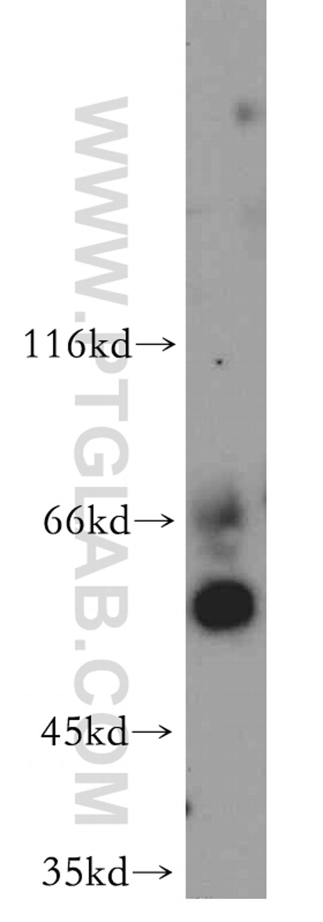 FOXJ3 Antibody in Western Blot (WB)