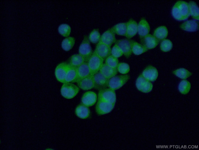 EPS15R Antibody in Immunocytochemistry (ICC/IF)