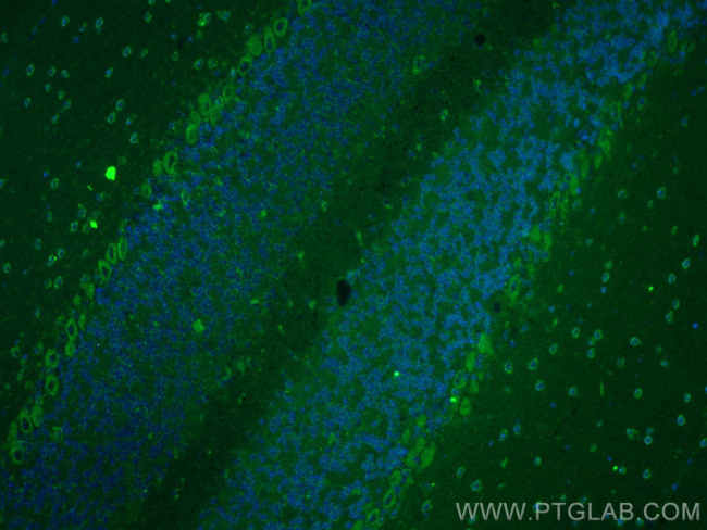 SYT2 Antibody in Immunohistochemistry (PFA fixed) (IHC (PFA))