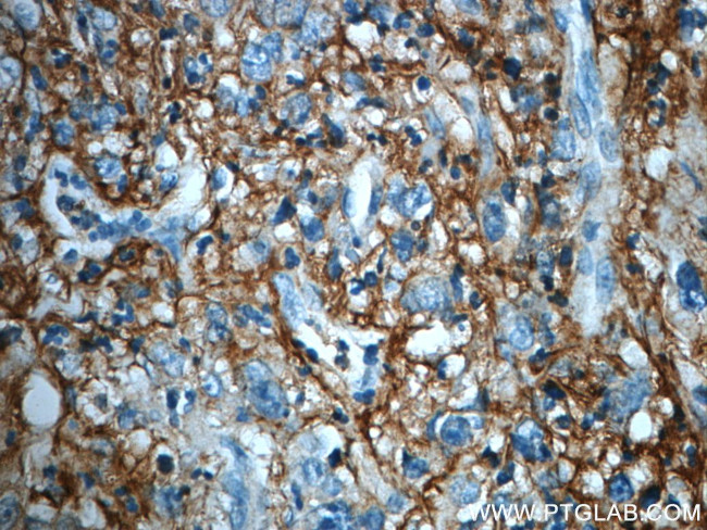 ITIH3 Antibody in Immunohistochemistry (Paraffin) (IHC (P))