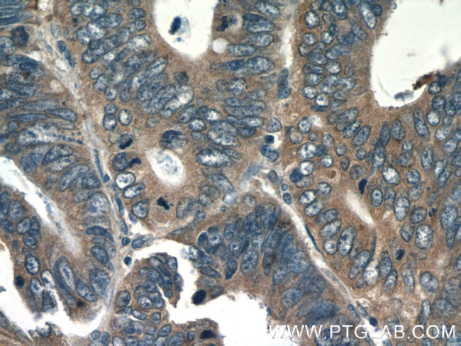 IL36 gamma Antibody in Immunohistochemistry (Paraffin) (IHC (P))