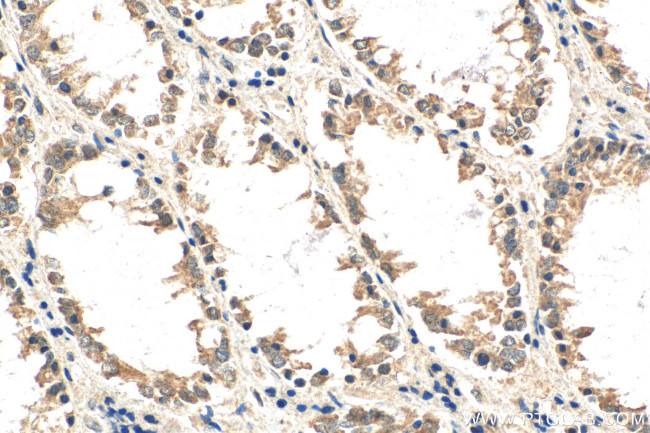 WISP3 Antibody in Immunohistochemistry (Paraffin) (IHC (P))