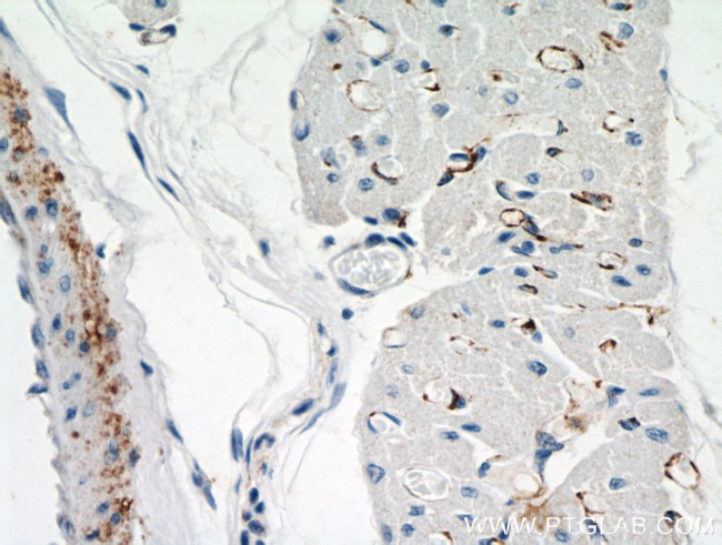 NEURL2 Antibody in Immunohistochemistry (Paraffin) (IHC (P))