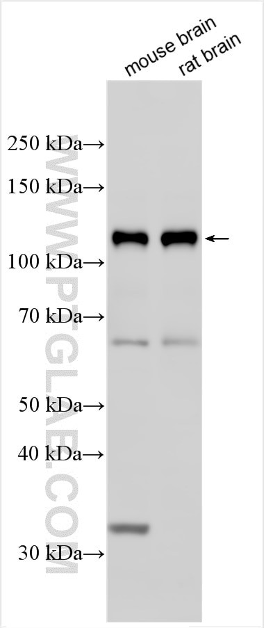 ASTN1 Antibody in Western Blot (WB)