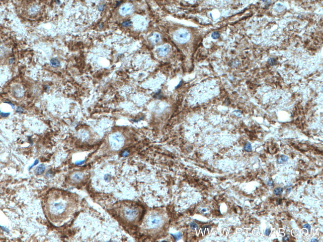 SV2C Antibody in Immunohistochemistry (Paraffin) (IHC (P))