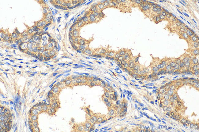 TMEM64 Antibody in Immunohistochemistry (Paraffin) (IHC (P))