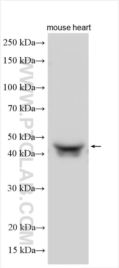 NT5C1A Antibody in Western Blot (WB)