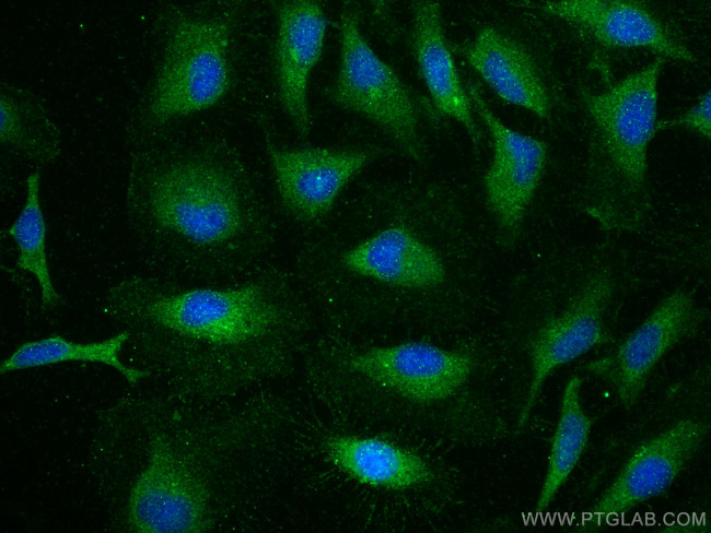SLC39A2 Antibody in Immunocytochemistry (ICC/IF)