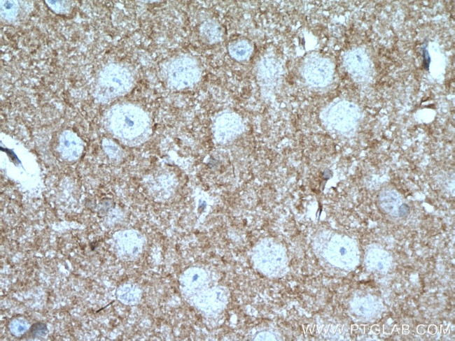 Kv4.2 Antibody in Immunohistochemistry (Paraffin) (IHC (P))