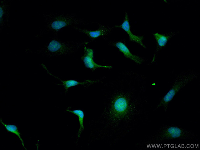 PLK5 Antibody in Immunocytochemistry (ICC/IF)