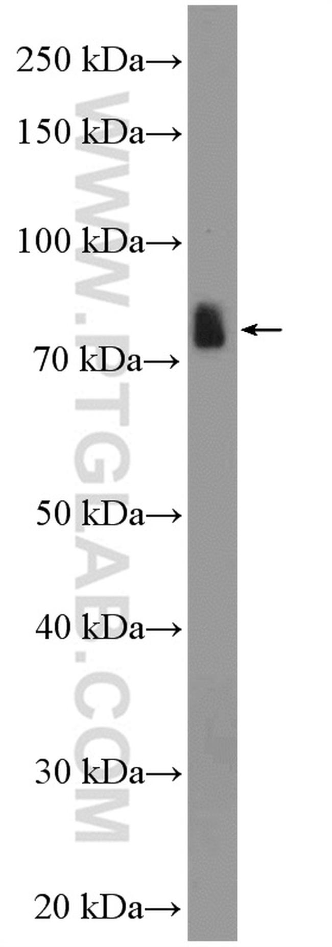 SATB2 Antibody in Western Blot (WB)