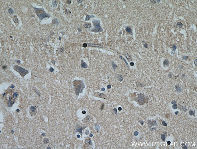 NHLRC1 Antibody in Immunohistochemistry (Paraffin) (IHC (P))