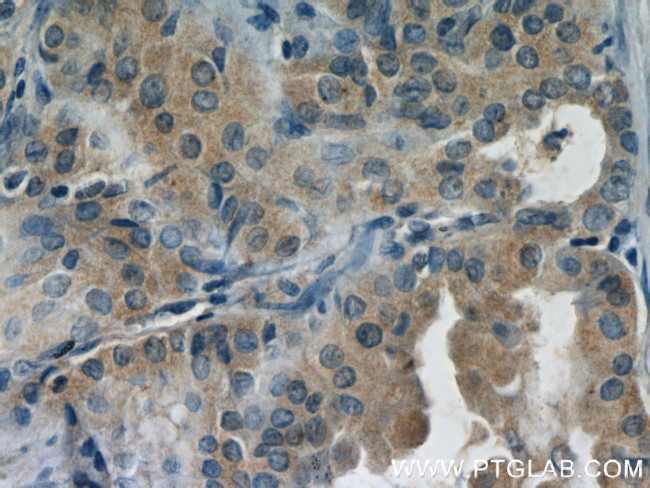 DEPDC6 Antibody in Immunohistochemistry (Paraffin) (IHC (P))