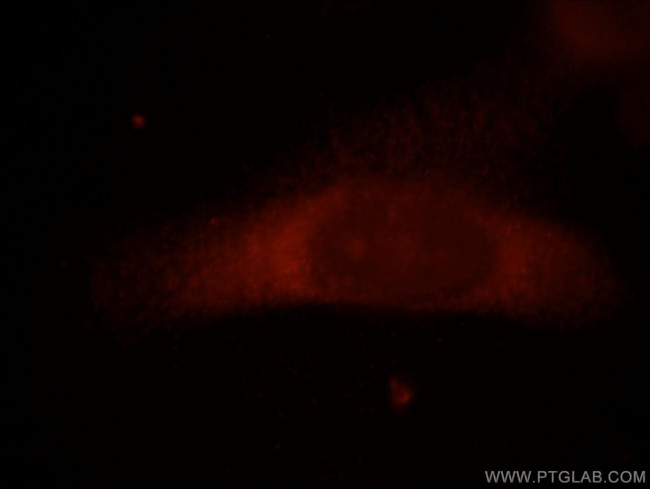 FAM124B Antibody in Immunocytochemistry (ICC/IF)