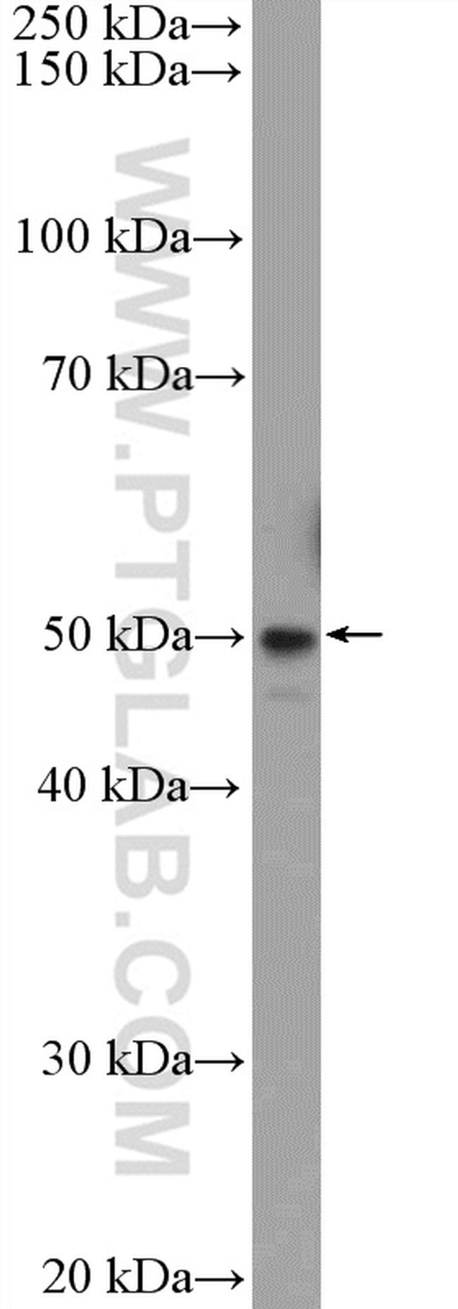 TMEM117 Antibody in Western Blot (WB)