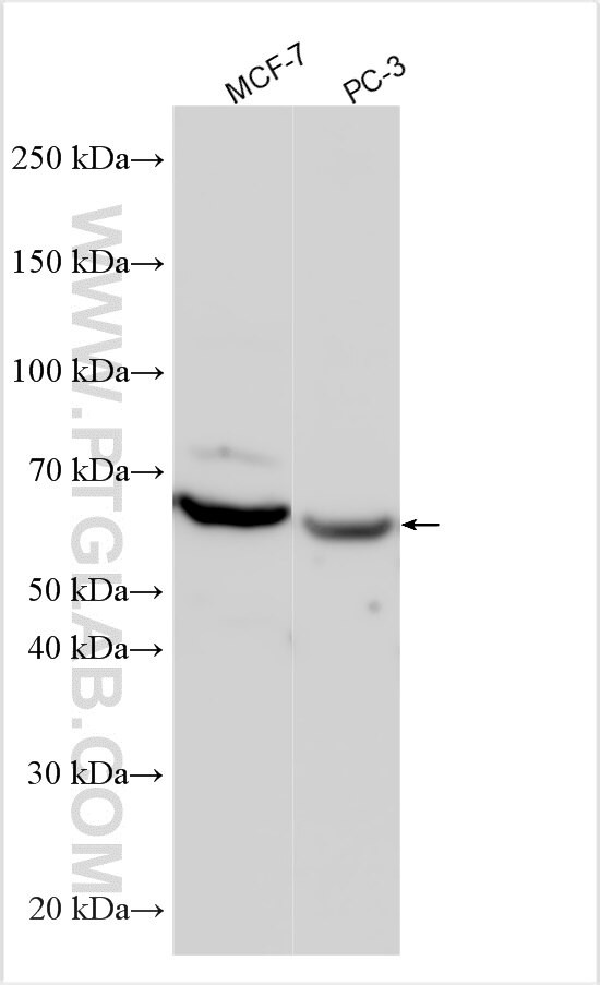 ZNF536 Antibody in Western Blot (WB)
