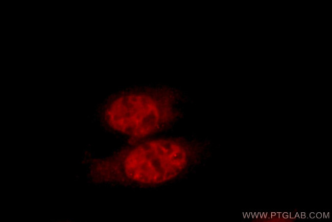 ZNF23 Antibody in Immunocytochemistry (ICC/IF)