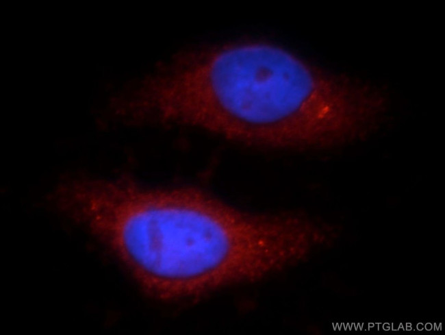 TTC39A Antibody in Immunocytochemistry (ICC/IF)