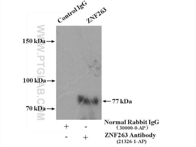 ZNF263 Antibody in Immunoprecipitation (IP)