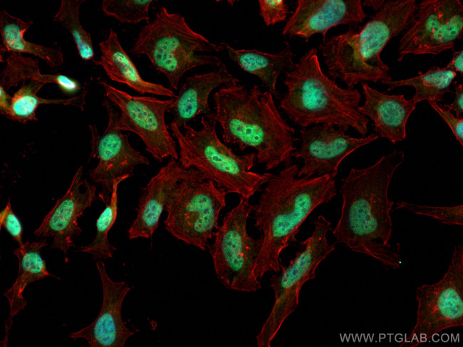 CHD2 Antibody in Immunocytochemistry (ICC/IF)