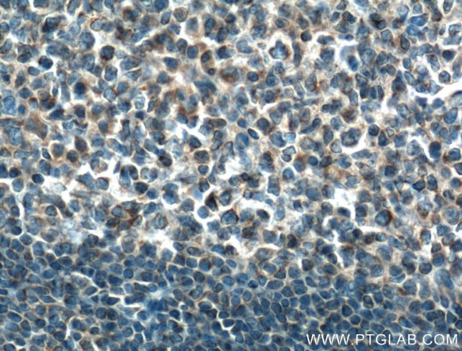 MTMR3 Antibody in Immunohistochemistry (Paraffin) (IHC (P))