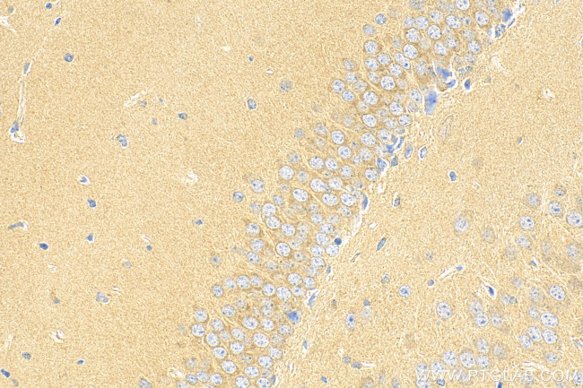 YIPF7 Antibody in Immunohistochemistry (Paraffin) (IHC (P))