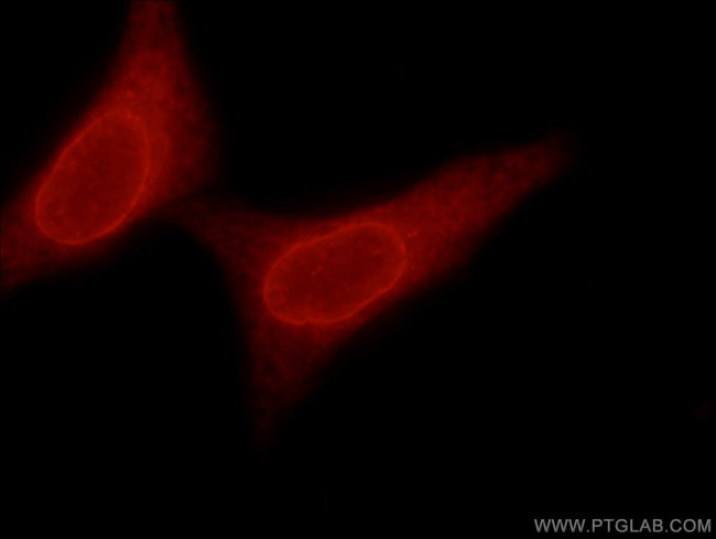 TMX4 Antibody in Immunocytochemistry (ICC/IF)