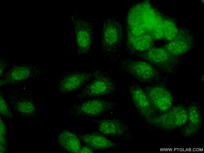 SNAI3 Antibody in Immunocytochemistry (ICC/IF)