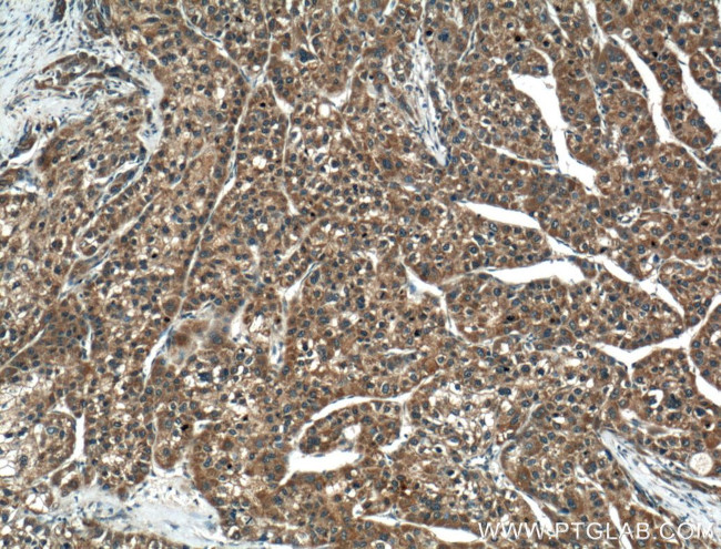 TMEM195 Antibody in Immunohistochemistry (Paraffin) (IHC (P))